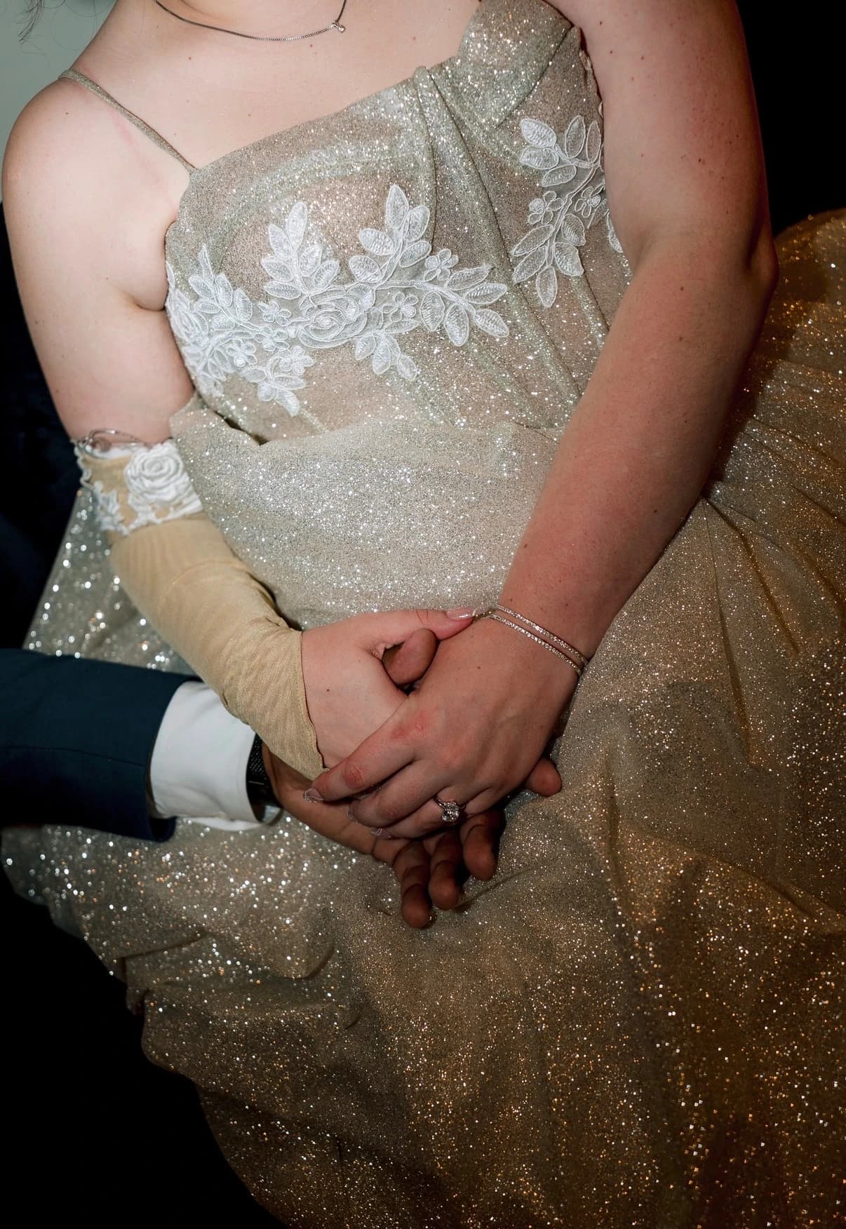 Close-up of a gold custom PICC line cover with floral lace detailing, worn with a bridal gown
